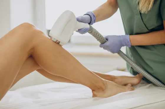 Depilación láser en las piernas con equipo profesional