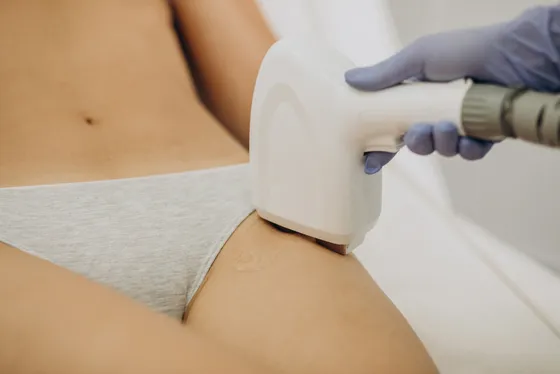 Depilación láser en la zona del bikini