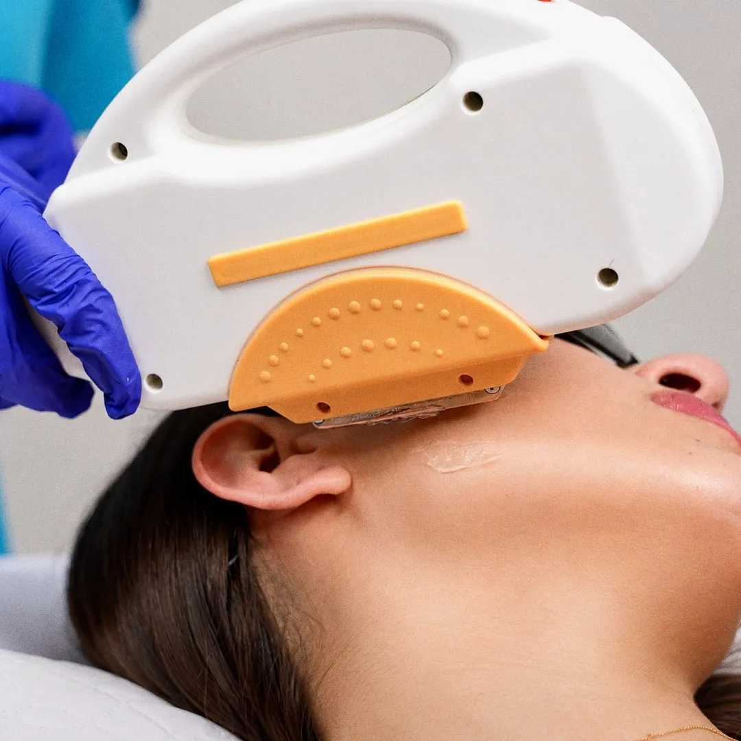Cabezal del láser sobre el rostro de una clienta con gafas de protección