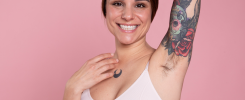 depilacion laser con tatutajes